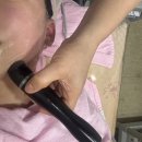 이끌림케어 | [구로 고척동 윤곽관리] 이끌림 밸런스케어 올리지오 400샷 리프팅 체험 후기