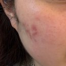 더피움 | [피부관리] 환절기에 피부 장벽을 튼튼하게 관리해주는 첨단 신용동 '더피움에스테틱'