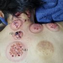 현대가축병원 | 전기로 암을 치료한다
