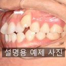 웃는E치과교정과치과의원 네이버블로그