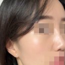 김은영 | 내돈내산 피부관리 김은영 코스메틱 2개월째 찐 후기