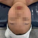 일상 속 힐링, 아크릴화 | 고양 에스테틱 원흥 루나에스테틱 바쁜 일상 속 힐링 10개월 찐 단골 후기