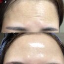 인생역전인셀덤 | K뷰티화장품 피부가 바뀌는 ICD,#강남인셀덤화장품 체험해보세요!