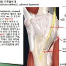 [10강(무릎)-9](66강-뉴만보강2) 안쪽곁인대(MCL), 가쪽곁인대(LCL) 구조, 움직임, 손상기전등 이미지