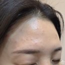 온천장역 3번출구 주변 | 부산 모공관리 온천장역 올리다 에스테틱 베르도소 관리 후기