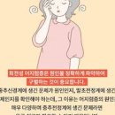 구토 어지러움 원인 구토 멈추는법 이미지