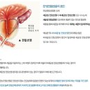 맑을청한의원 | 부산맑을청한의원은 난치성만성전립선염을 중점적으로 치료합니다.