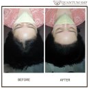 영헤어라인 이미지