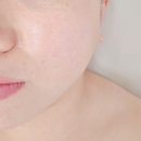 창원1 | 창원에스테틱 :: 아기로가 에스테틱 :: 이중턱관리 1회 후기