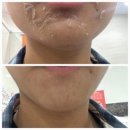 수얀스킨케어