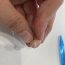 독일보청기 부천원미구청센터 이미지