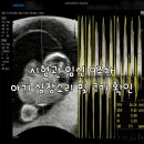아인투 | 시험관 임신 9주차 아인병원 진료 후기쌍둥이 초음파 사진 공개