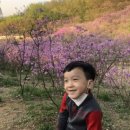 소아, 유아 어린이 부정교합, 반대교합 교정 / 소아,유아 교정치과 / 프랑켈 교정장치 착용 8개월 후기