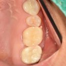 애플치과기공소 이미지