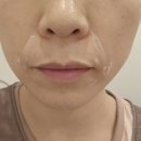 석전동502 | 마산 피부과 마산필러 피부클리닉 시술 후기