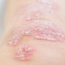 소사벌휴먼피부과의원 이미지