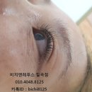 비치앤레푸스