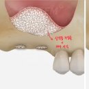 연세강치과의원 이미지
