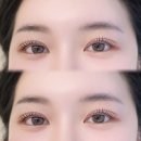 링링브로우 이미지