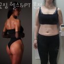 센츄리헬스 이미지