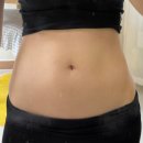 오렌지한의원 | 강남라인한의원 [다이어트 슬림환] 웨딩관리 2주일 후기