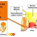 장 및 직장 - 직장 근육(하부 직장)과 외부 직장 괄약근 이미지
