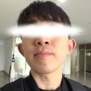 더젊어졌네 | 명동피부과 제모 남자수염 5회차 say 깔끔해서 만족 내돈내산 피부과 후기 (젠틀맥스프로플러스)