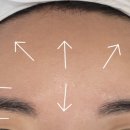 썬헤어라인 이미지