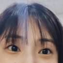 오렌지의원 | 오렌지성형외과 쌍커풀 수술후기 (한쪽만)