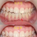 박보령