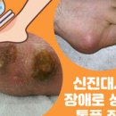 양산우리편한내과의원 네이버블로그