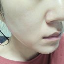 스킨지키미 | 오젬픽페이스 탄력크림 SOEREVE 아쿠아티놀 스킨 부스트 크림 수분 보호막 지키미