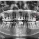 확실한강치과의원 | 목포 임플란트 잘하는 치과 - 확실한강치과의원.