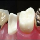 세계로치과기공소 이미지