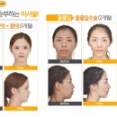 미서울성형외과 네이버블로그
