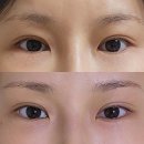 UR(오산시)-[내삼미로]-하-2 | 생체전류를 통한 체형교정 내돈내산 12회 후기, 더 어여쁜 피부관리