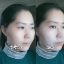 비포런스