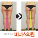 비너스의원 이미지