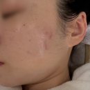 영인케어 이미지