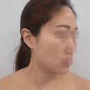 스텔라보떼