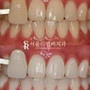 서울리멤버치과의원 이미지