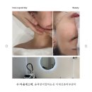 윤곽관리잘하는곳 찾는다면, 이대신촌피부관리 수라움에스떼 FACE 시그니처 테라피 후기