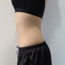 상상의원 | 상상만 하던 아랫배 라인, MPL주사 의원 4회차 후기예요