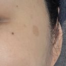 애오개약국 이미지