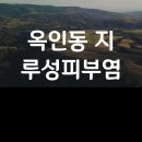 옥인동 지루성피부염 좋아진 후기