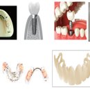 세계로치과기공소 이미지