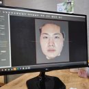 강남안면비대칭 한의원 10회케어까지 완료 차이점 후기