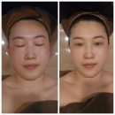 고결 | 부산 윤곽전문관리 화명동 에스테틱 고결 만족후기