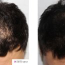 모앤라인성형외과의원 네이버블로그