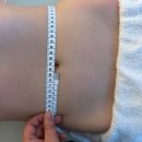 한결메디케어 | 한 번에 3cm 감소?! 첨단 지방흡입 후 관리 후기 – 메디케어 스킨앤바디